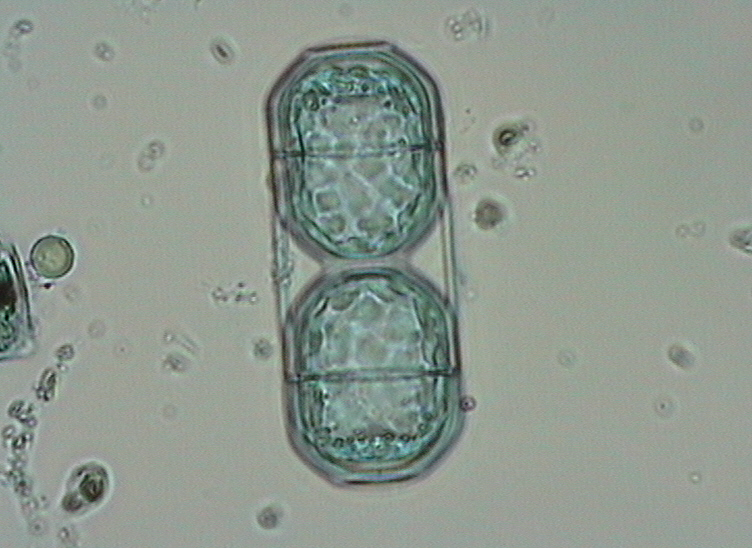 Dictyocha speculum